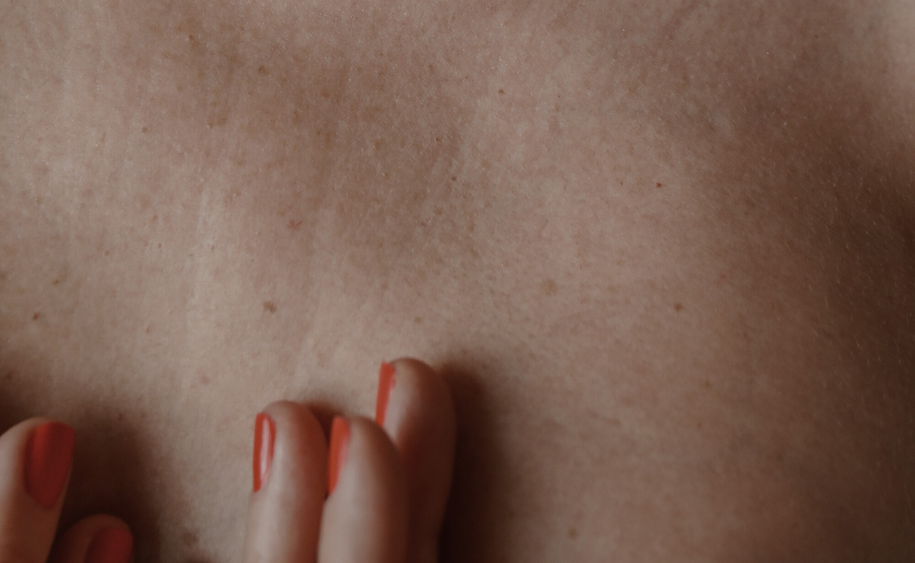 Piel de una mujer diabética que muestra signos de glicación y sus efectos secundarios de envejecimiento prematuro